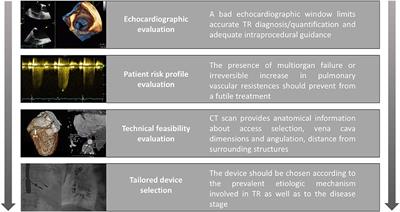 New Percutaneous Options for Tricuspid Intervention: How to Identify the Good Clinical Candidate